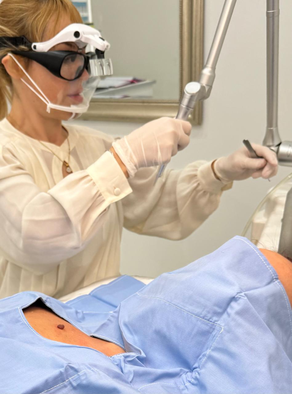 Remoción de tatuajes paso a paso