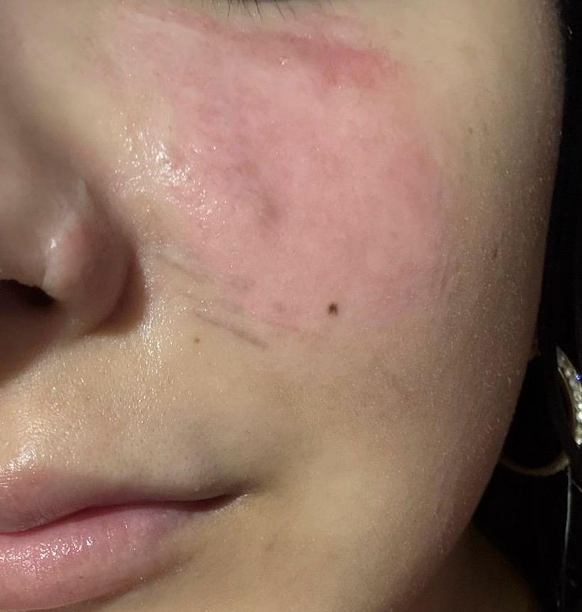 Reconstrucción Caso 2 - Después