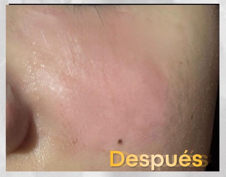 Medicina Reconstructiva - Después